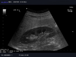 Ultrazvok ledvic - ledvica normalne velikosti in parenhima